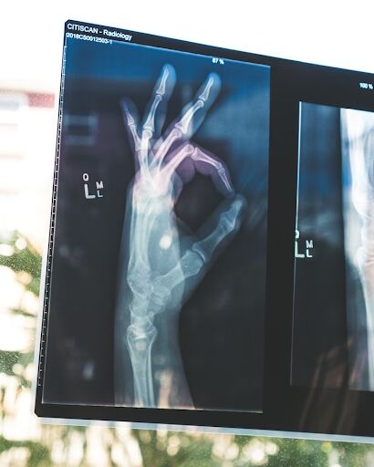The Key Role of Bone Health in Supporting an Active Lifestyle